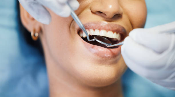 Best Emergency Gum Pain Relief  in Gold River, CA
